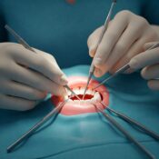 Cirugia oral Cirugia oral